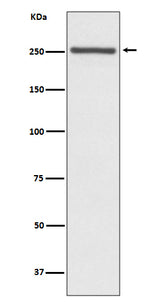 Anti-NOTCH4 Rabbit Monoclonal Antibody Boster Bio
