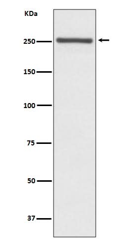 Anti-NOTCH4 Rabbit Monoclonal Antibody Boster Bio