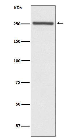 Anti-NOTCH4 Rabbit Monoclonal Antibody Boster Bio
