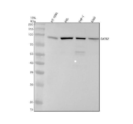 Anti-SATB2 Rabbit Monoclonal Antibody Boster Bio