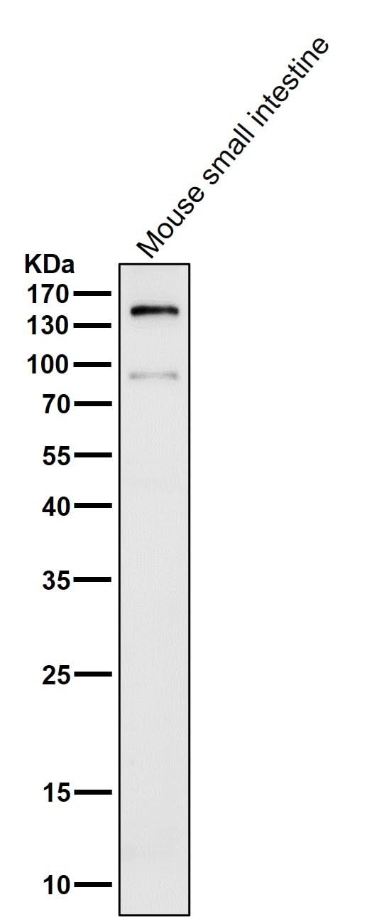 Anti-CD13 ANPEP Rabbit Monoclonal Antibody Boster Bio