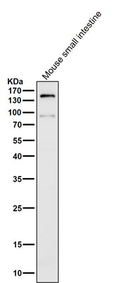 Anti-CD13 ANPEP Rabbit Monoclonal Antibody Boster Bio