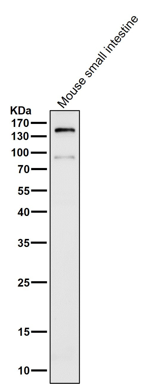 Anti-CD13 ANPEP Rabbit Monoclonal Antibody Boster Bio