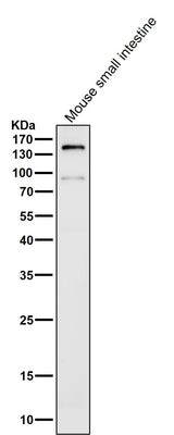 Anti-CD13 ANPEP Rabbit Monoclonal Antibody Boster Bio