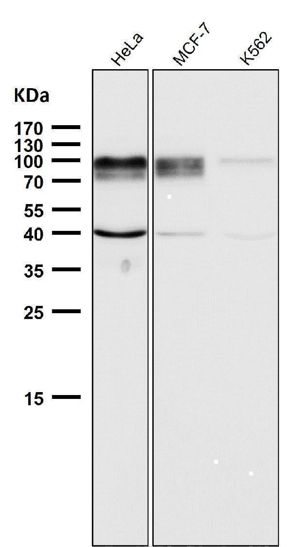 Anti-ADAM15 Rabbit Monoclonal Antibody Boster Bio