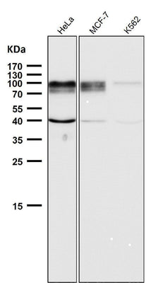 Anti-ADAM15 Rabbit Monoclonal Antibody Boster Bio