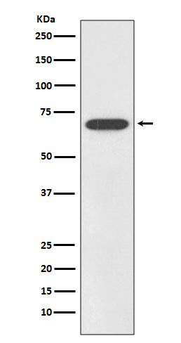 Anti-SOX11 Rabbit Monoclonal Antibody Boster Bio