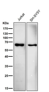 Anti-ACADVL/VLCAD Rabbit Monoclonal Antibody Boster Bio