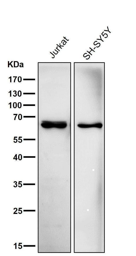 Anti-ACADVL/VLCAD Rabbit Monoclonal Antibody Boster Bio