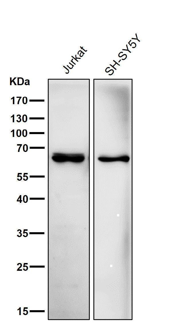 Anti-ACADVL/VLCAD Rabbit Monoclonal Antibody Boster Bio