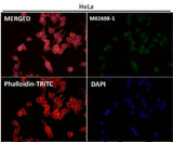 Anti-JNK1/2/3 MAPK8 Rabbit Monoclonal Antibody Boster Bio