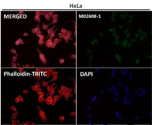 Anti-JNK1/2/3 MAPK8 Rabbit Monoclonal Antibody Boster Bio