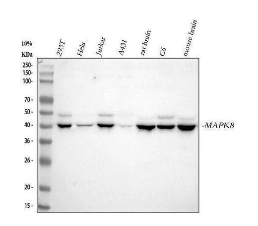 Anti-JNK1 Rabbit Monoclonal Antibody Boster Bio