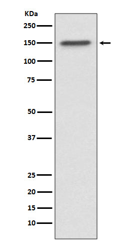 Anti-ASPP2 Rabbit Monoclonal Antibody Boster Bio