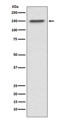 Anti-ASPP2 Rabbit Monoclonal Antibody Boster Bio