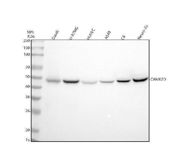 Anti-CaMKII delta CAMK2D Rabbit Monoclonal Antibody Boster Bio