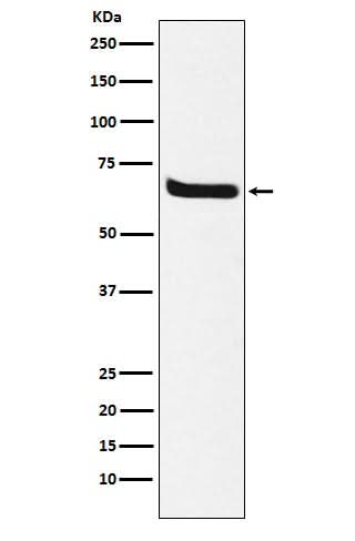 Anti-Klotho Rabbit Monoclonal Antibody Boster Bio