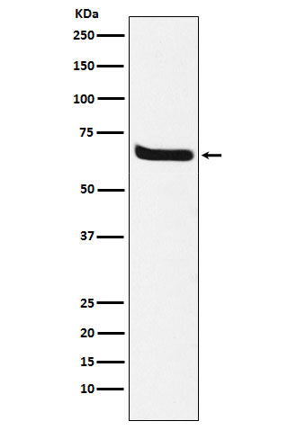 Anti-Klotho Rabbit Monoclonal Antibody Boster Bio