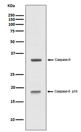 Anti-Caspase-6 p18 CASP6 Rabbit Monoclonal Antibody Boster Bio