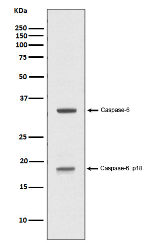 Anti-Caspase-6 p18 CASP6 Rabbit Monoclonal Antibody Boster Bio