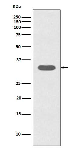 Anti-Caspase-6 CASP6 Rabbit Monoclonal Antibody Boster Bio