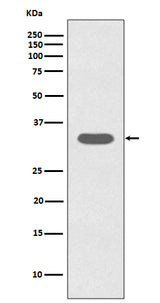 Anti-Caspase-6 CASP6 Rabbit Monoclonal Antibody Boster Bio