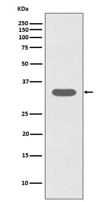 Anti-Caspase-6 CASP6 Rabbit Monoclonal Antibody Boster Bio