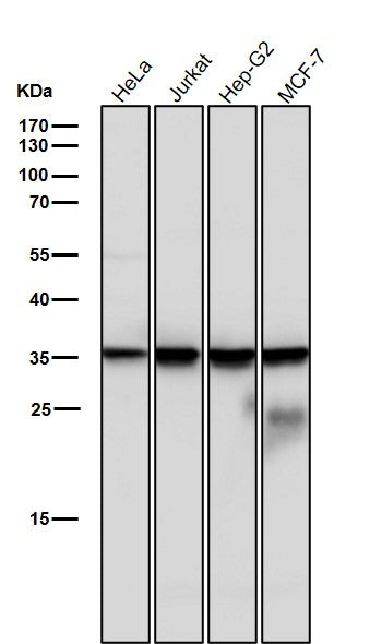 Anti-Caspase-6 Rabbit Monoclonal Antibody Boster Bio