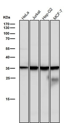 Anti-Caspase-6 Rabbit Monoclonal Antibody Boster Bio