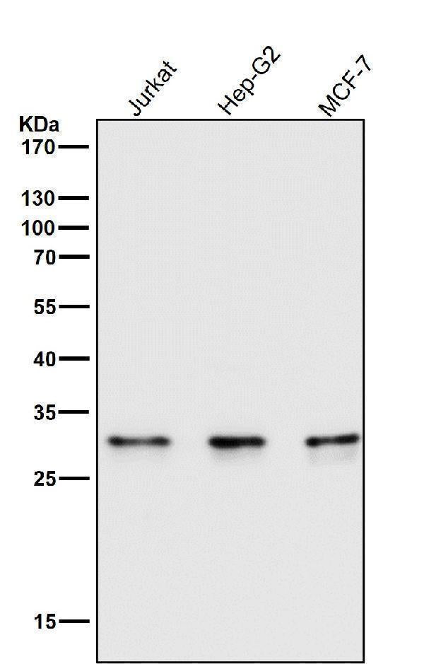 Anti-Caspase-6 CASP6 Rabbit Monoclonal Antibody Boster Bio