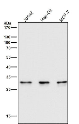 Anti-Caspase-6 CASP6 Rabbit Monoclonal Antibody Boster Bio