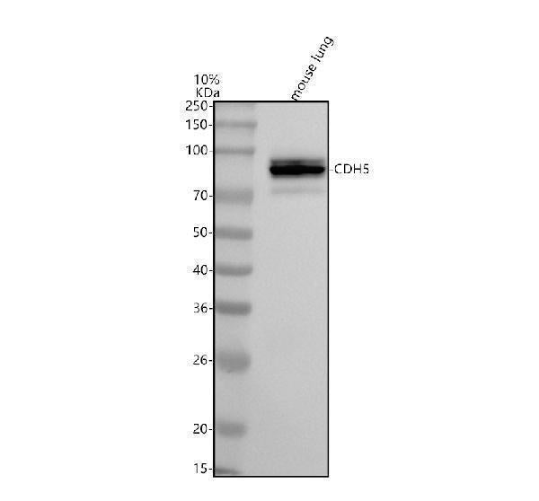 Anti-VE-Cadherin Cdh5-Rabbit Monoclonal Antibody Boster Bio
