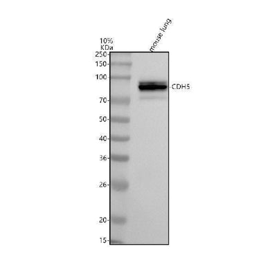 Anti-VE-Cadherin Cdh5-Rabbit Monoclonal Antibody Boster Bio