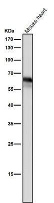 Anti-Yes1 Rabbit Monoclonal Antibody Boster Bio