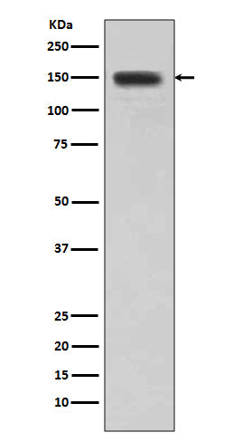 Anti-DSG1/Desmoglein 1 Rabbit Monoclonal Antibody Boster Bio