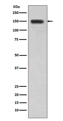 Anti-DSG1/Desmoglein 1 Rabbit Monoclonal Antibody Boster Bio