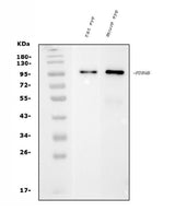 Anti-PDE6 beta/PDE6B Antibody Picoband® (monoclonal, 8I2D7 Boster Bio
