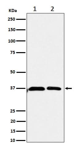 Anti-Serine racemase Rabbit Monoclonal Antibody Boster Bio