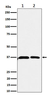 Anti-Serine racemase Rabbit Monoclonal Antibody Boster Bio