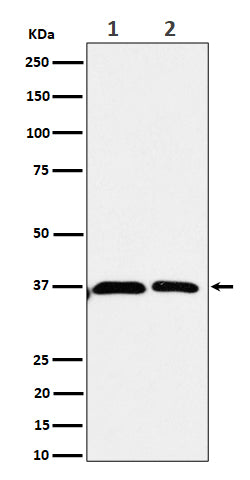 Anti-Serine racemase Rabbit Monoclonal Antibody Boster Bio