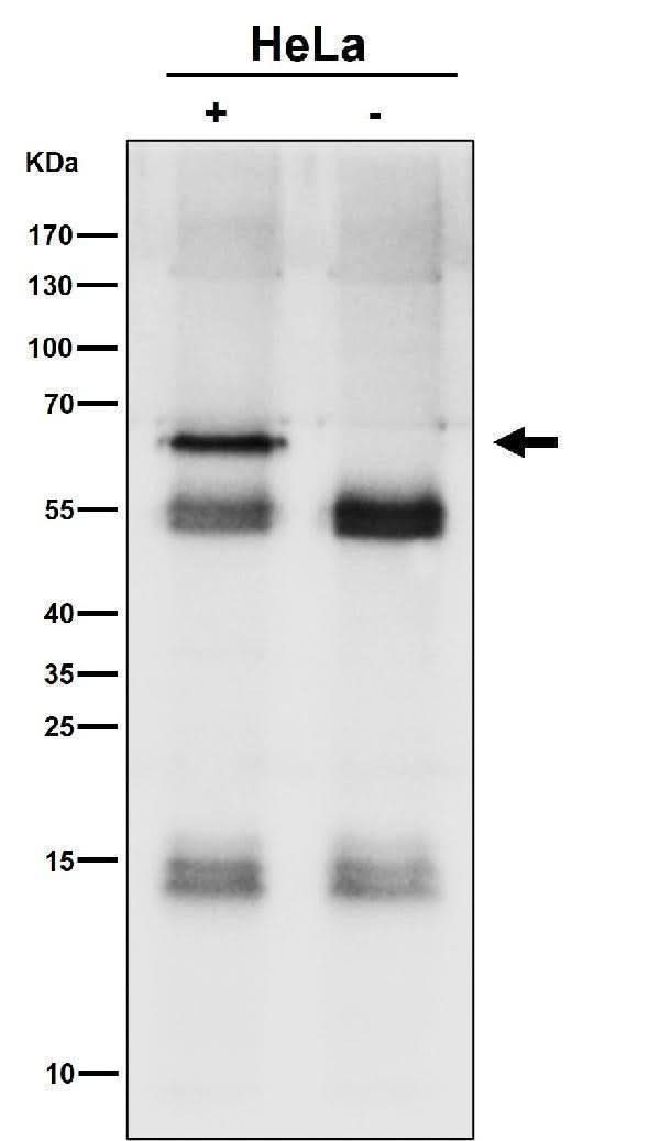 Anti-SYVN1 / HRD1 Rabbit Monoclonal Antibody Boster Bio