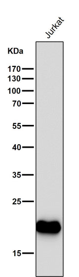 Anti-CD3 epsilon Rabbit Monoclonal Antibody Boster Bio