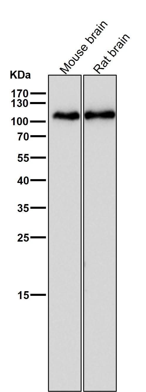 Anti-GluR1 GRIA1 Rabbit Monoclonal Antibody Boster Bio