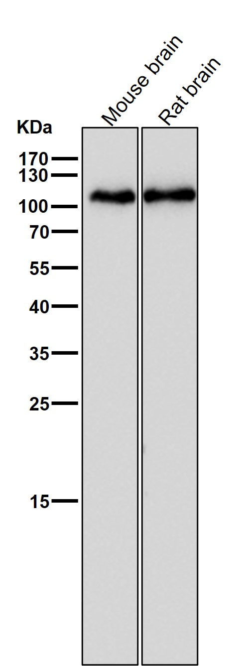 Anti-GluR1 GRIA1 Rabbit Monoclonal Antibody Boster Bio