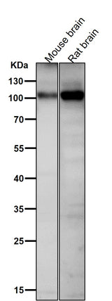 Anti-Phospho-AMPA Receptor 1 (S831) Rabbit Monoclonal Antibody Boster Bio