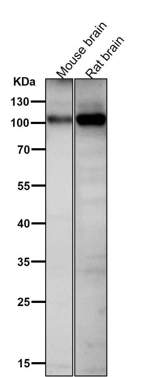 Anti-Phospho-AMPA Receptor 1 (S831) Rabbit Monoclonal Antibody Boster Bio