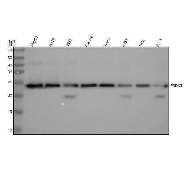 Anti-Peroxiredoxin 3 Rabbit Monoclonal Antibody Boster Bio