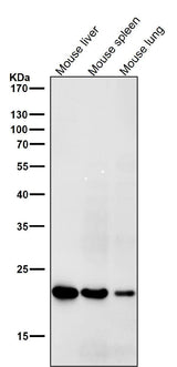 Anti-HE4 WFDC2 Rabbit Monoclonal Antibody Boster Bio