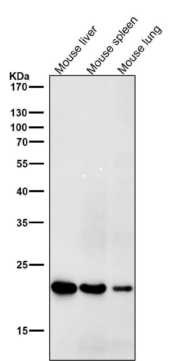 Anti-HE4 WFDC2 Rabbit Monoclonal Antibody Boster Bio