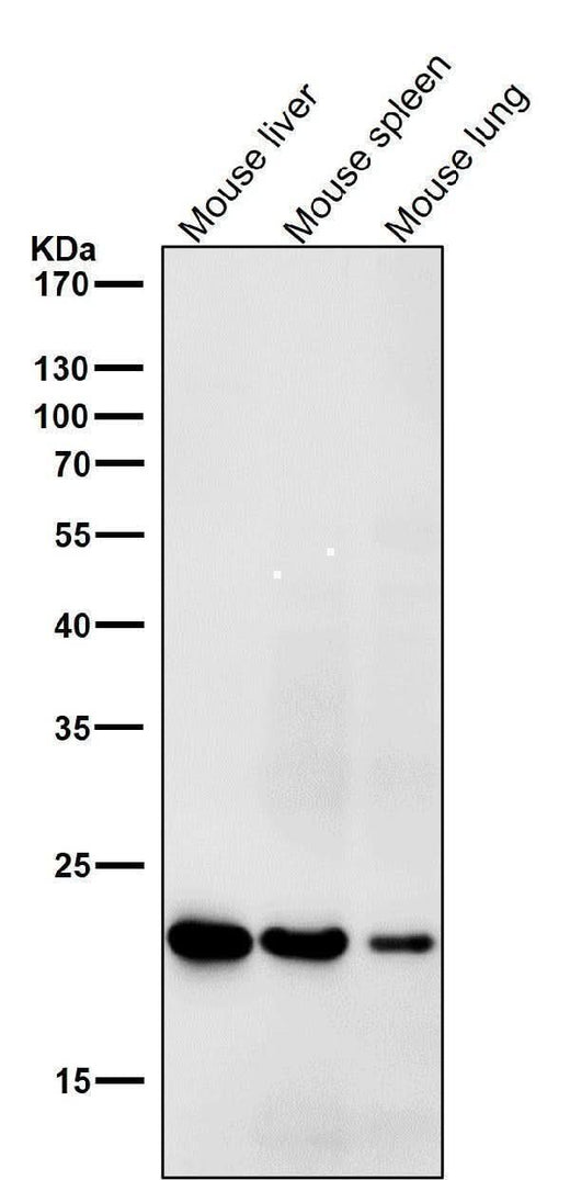 Anti-HE4 WFDC2 Rabbit Monoclonal Antibody Boster Bio